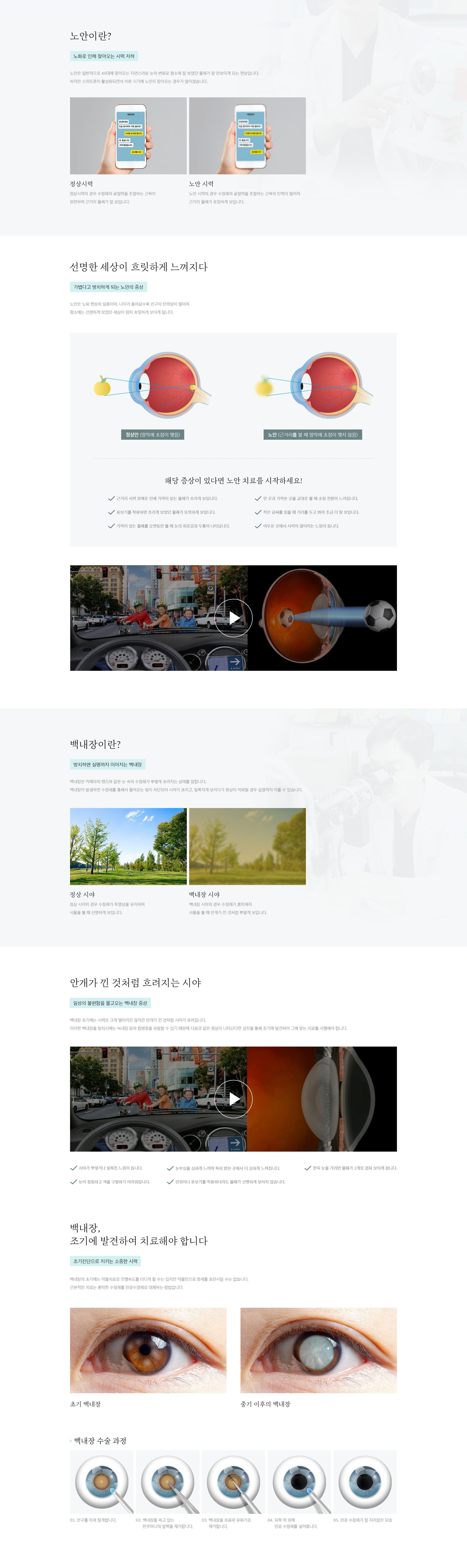 노안, 백내장