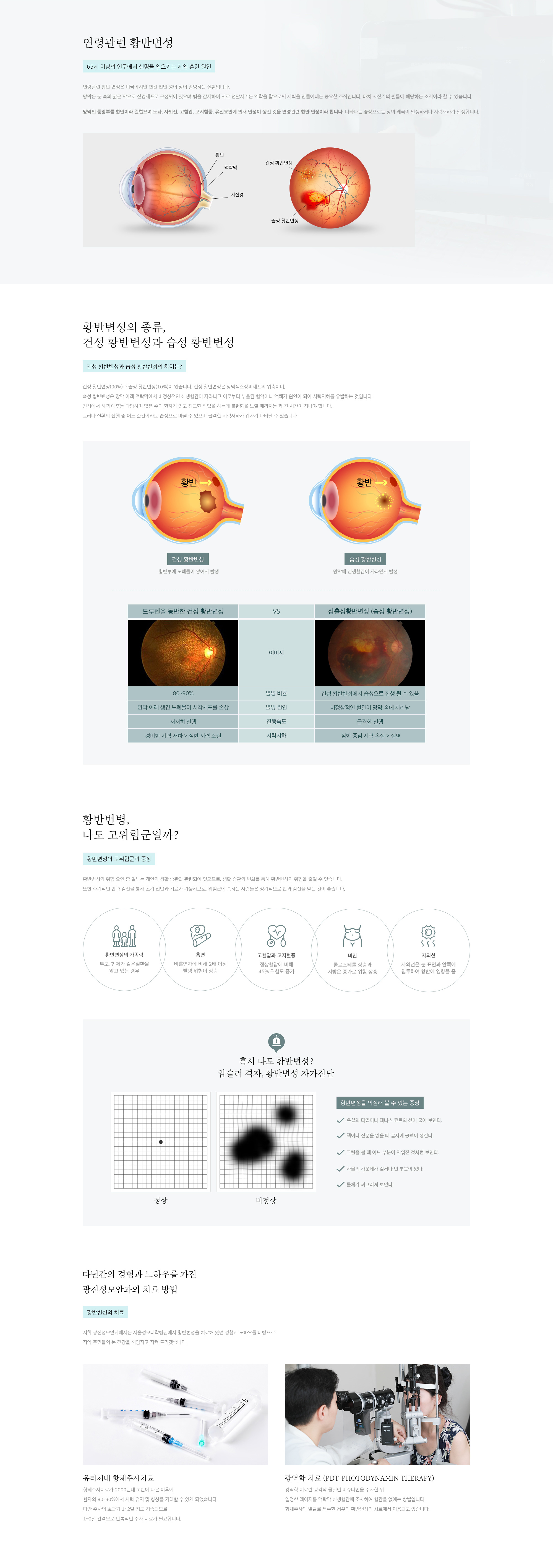 황반변성