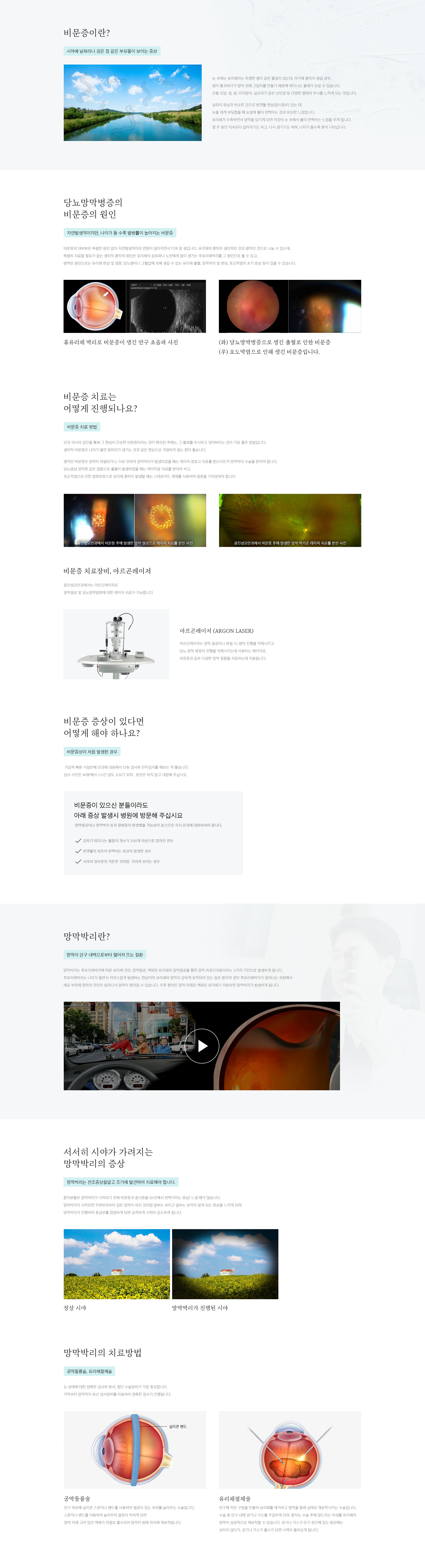 비문증, 망막박리