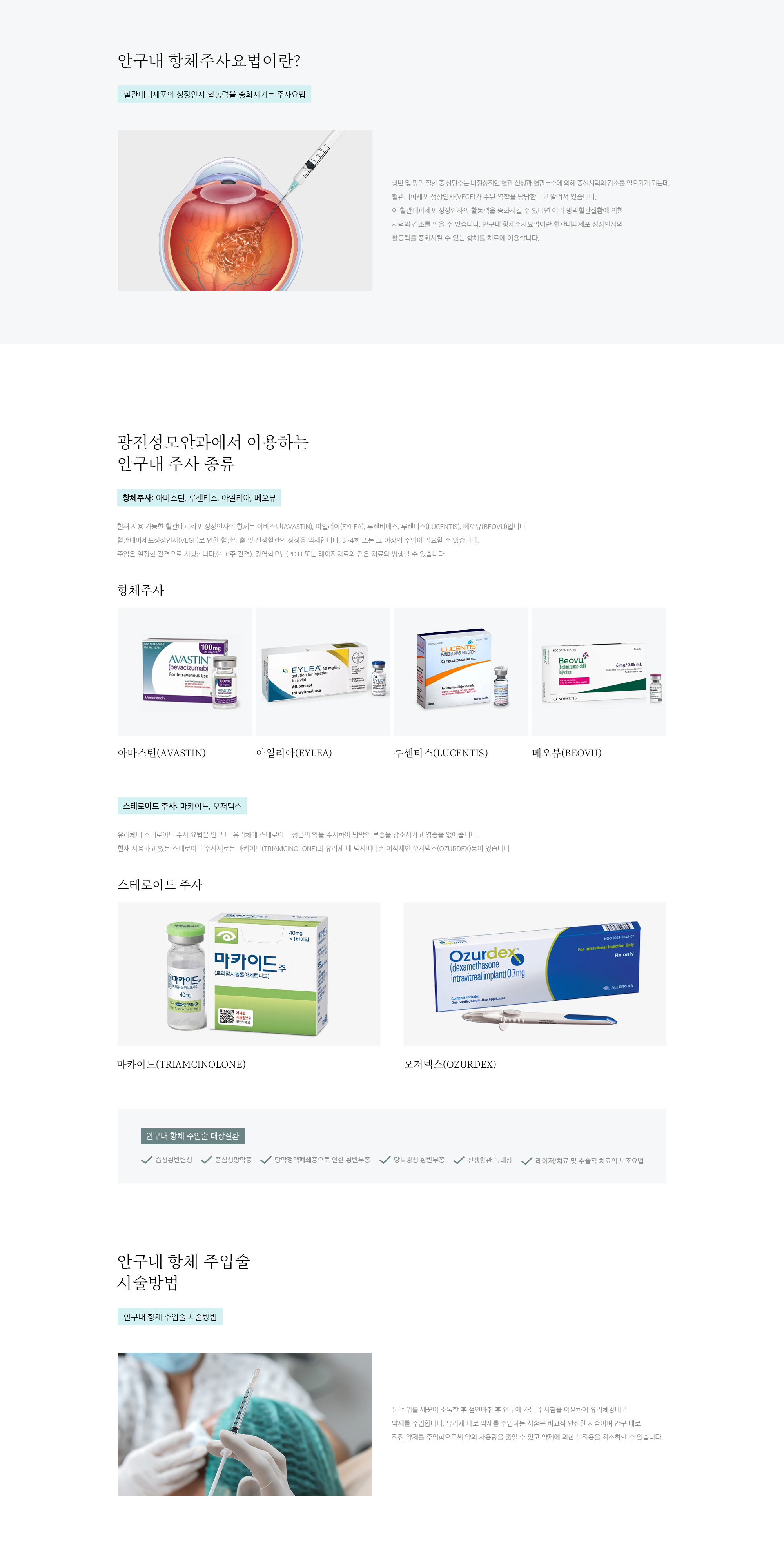 안구내 항체주입술