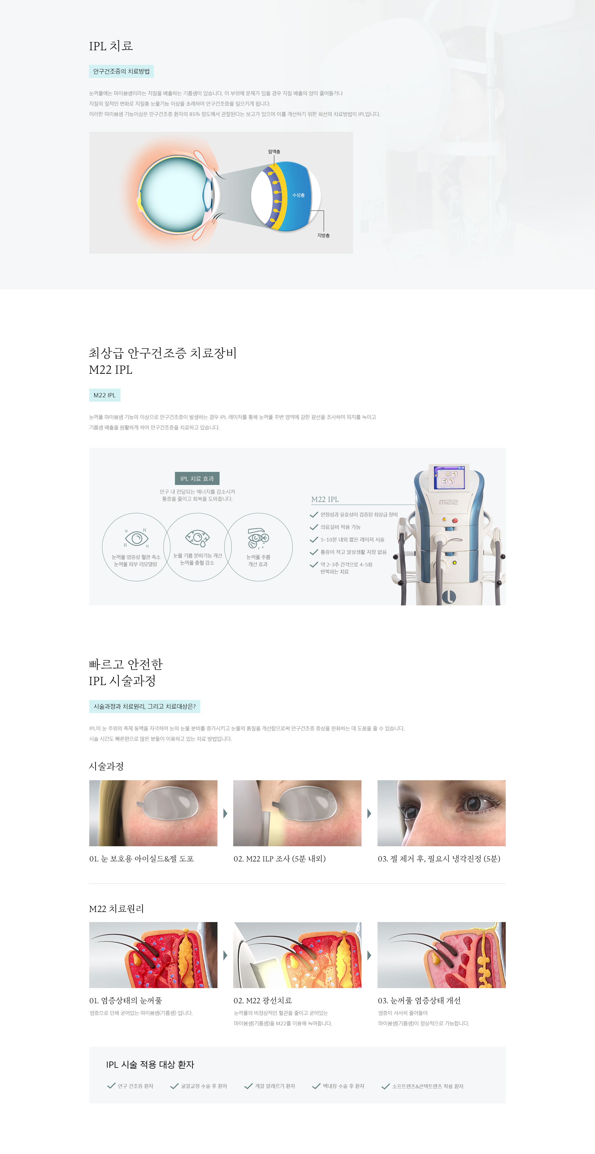 IPL레이저